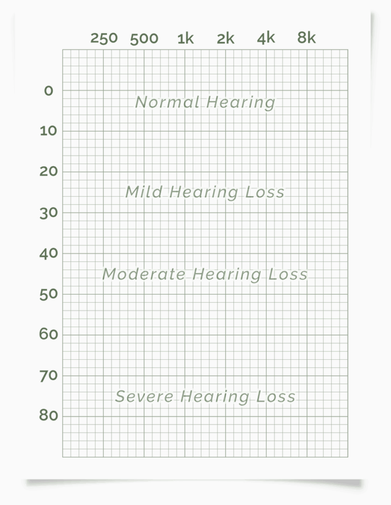 Online Hearing Test U0026 Audiogram Printout
