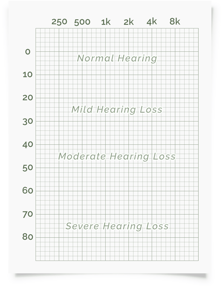Online Hearing Test U0026 Audiogram Printout
