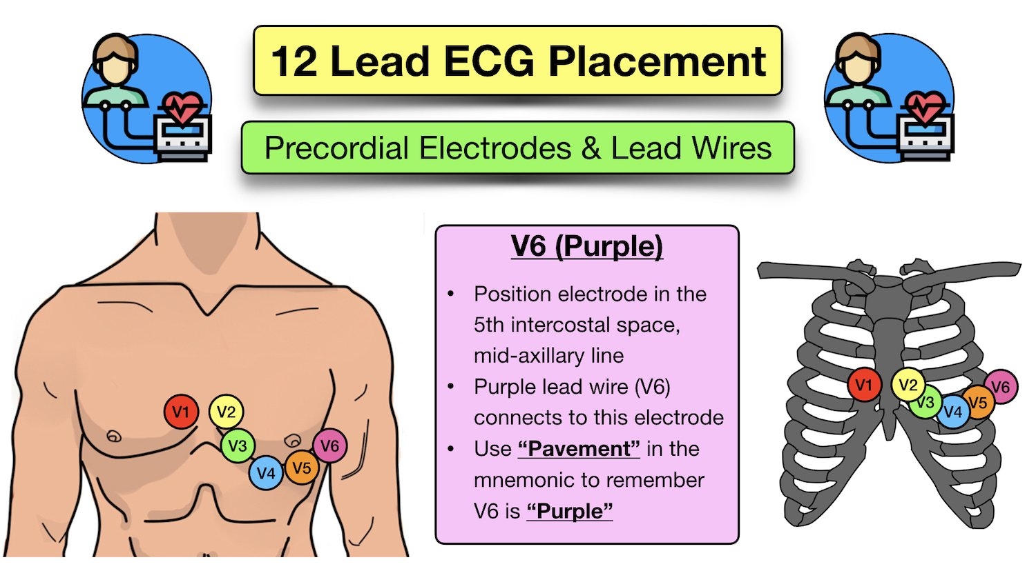 12 Lead ECG Placement Diagram And Mnemonic For Limb And Precordial Electrode Location EZmed
