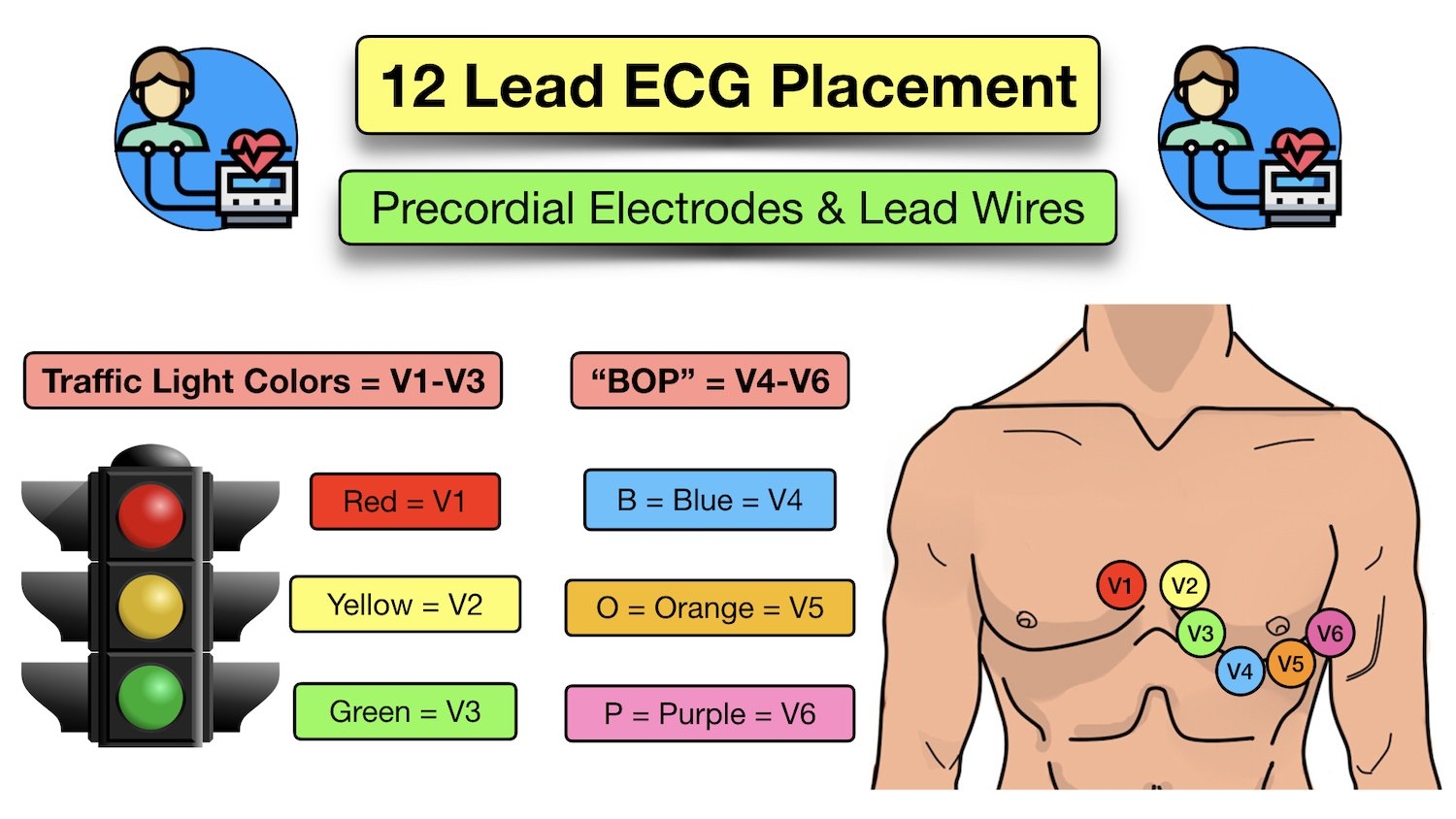 Printable 12 Lead Ecg Cheat Sheet