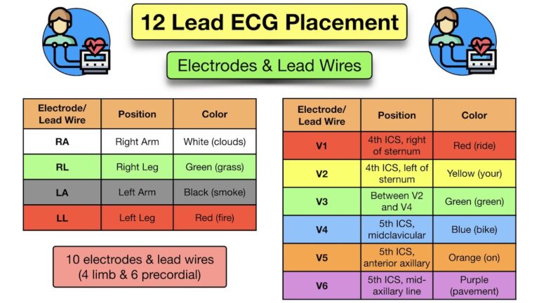 12 Lead ECG Placement Diagram And Mnemonic For Limb And Precordial Electrode Location EZmed