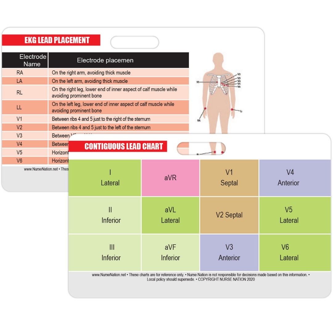 STEMI 12 Lead Reference And 12 Lead EKG ECG Placement Reference Horizontal Badge Card Etsy UK