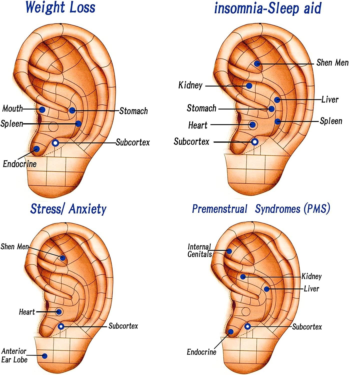 Printable Ear Seed Placement Chart Printable Ear Seed Placement Chart
